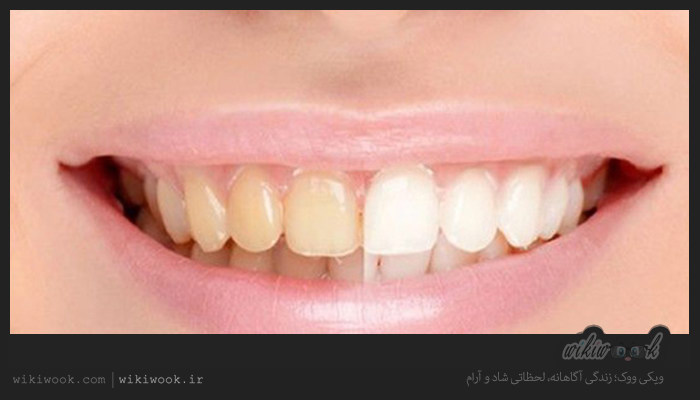 دندانها