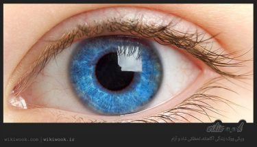 سرطان چشم چیست؟ / ویکی ووک