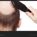 برای جلوگیری از ریزش مو چه باید کرد؟ / ویکی ووک
