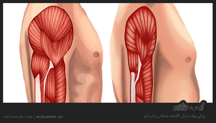 سارکوپنیا