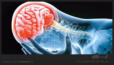 سکته مغزی چیست؟ / ویکی ووک